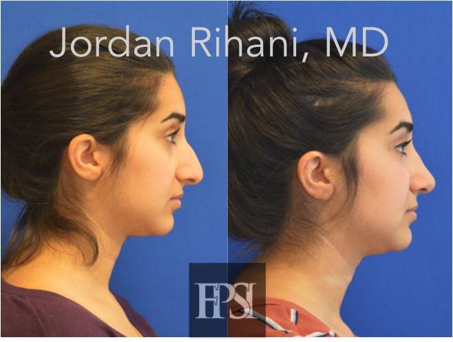 Facial Plastic Surgery Institute | 521 W Southlake Blvd #175, Southlake, TX 76092, USA | Phone: (817) 328-8380