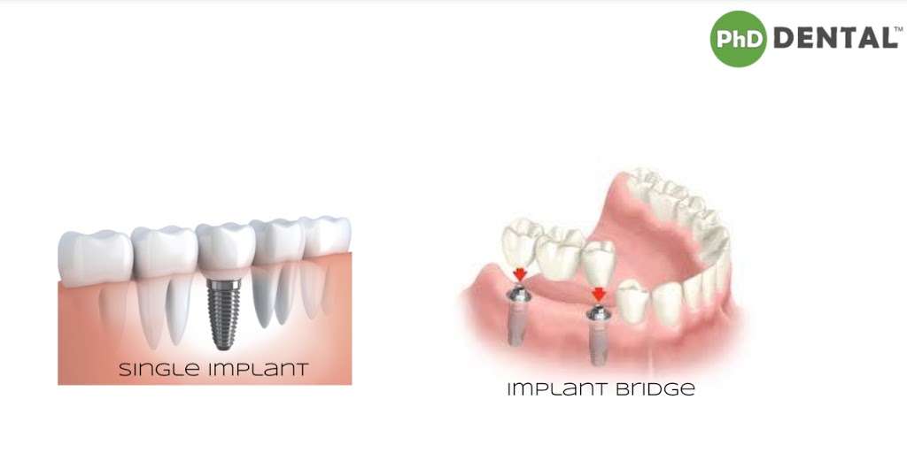 PhD Dental Los Angeles | 3000 Whittier Blvd, Los Angeles, CA 90023, USA | Phone: (323) 269-5437