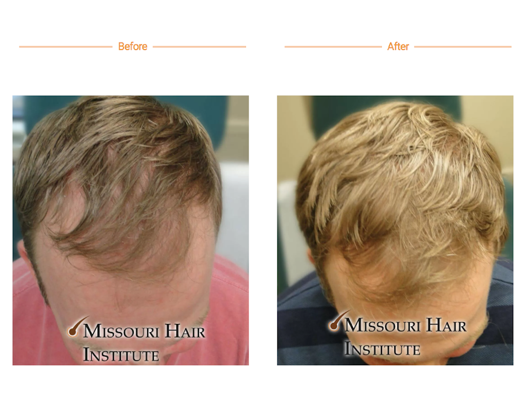 Missouri Hair Institute | 556 Rush Creek Parkway #B2, Liberty, MO 64068, USA | Phone: (816) 792-3400