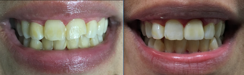 Dental Garden | 8710 Grand Mission Blvd A, Richmond, TX 77407, USA | Phone: (281) 853-9215