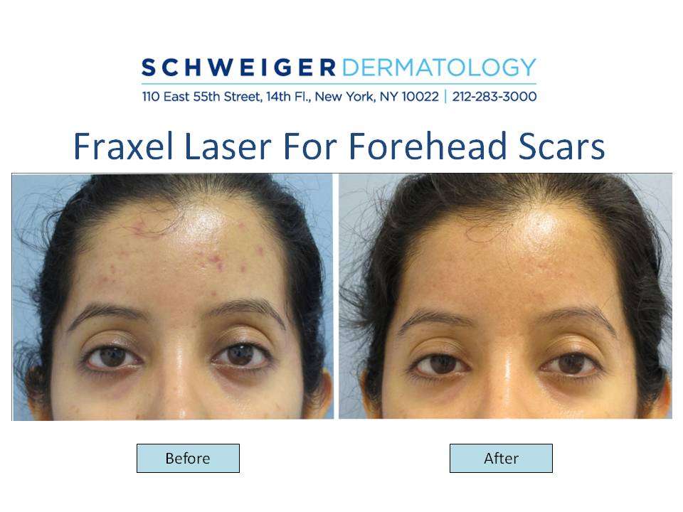 Schweiger Dermatology Group - Yonkers | 35 E Grassy Sprain Rd Suite #507, Yonkers, NY 10710, USA | Phone: (646) 665-3635