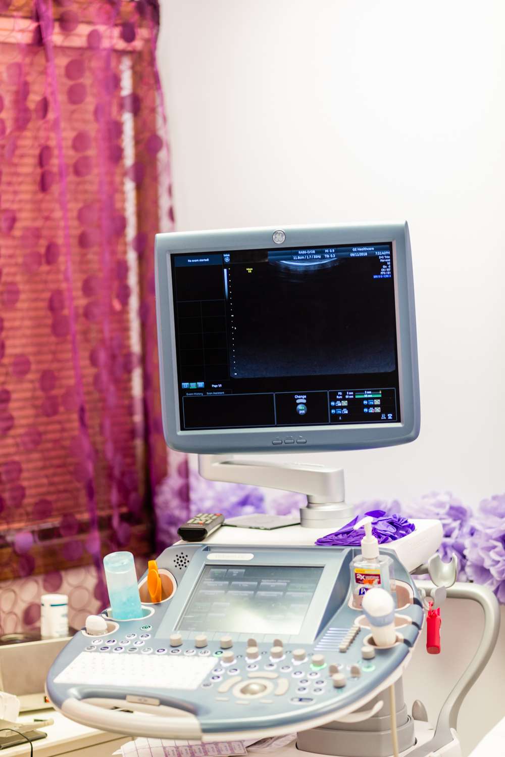 Baby Face 4D Ultrasound | 1387 Shadeland Ave suite c, Indianapolis, IN 46219, USA | Phone: (317) 914-2089