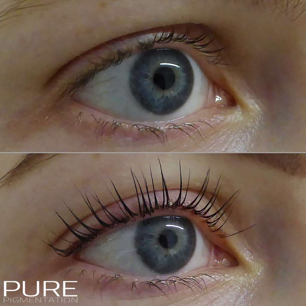 Pure Pigmentation | 9 Fenemore Rd, Caterham, Kenley CR8 5GJ, UK | Phone: 0845 643 1233