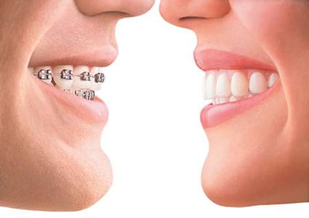 San Angel Dental | 4808, 8682 Beach Blvd #102, Buena Park, CA 90620 | Phone: (714) 484-9050