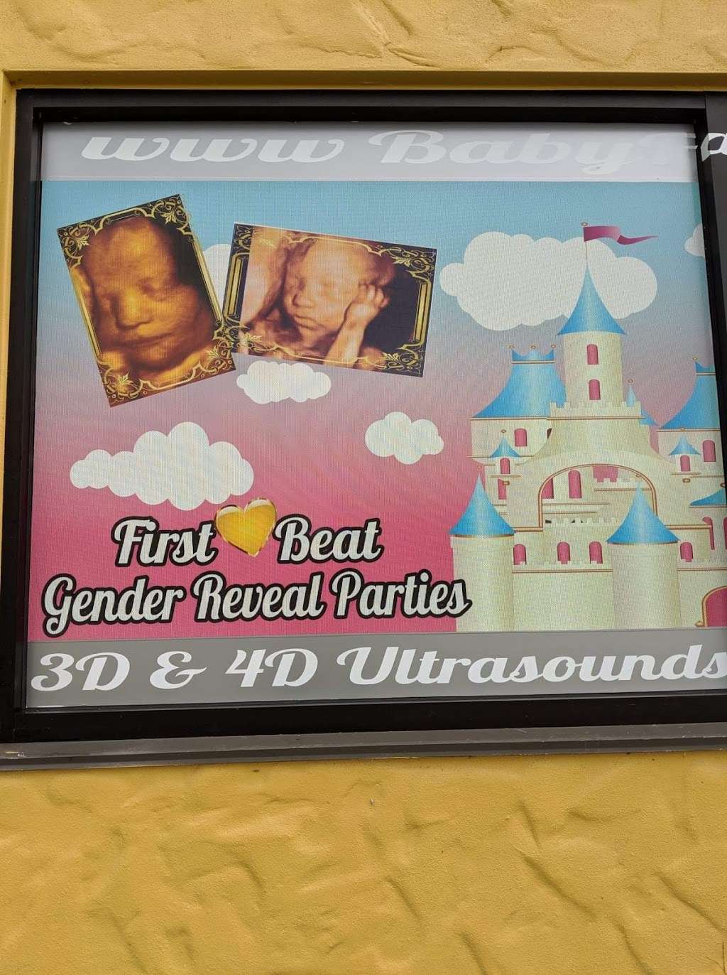 Baby Fairy Tale - 3d 4d HDLive Ultrasound, Pregnancy & Baby Phot | 1899 Murrell Rd #154, Rockledge, FL 32955, USA | Phone: (321) 722-7771