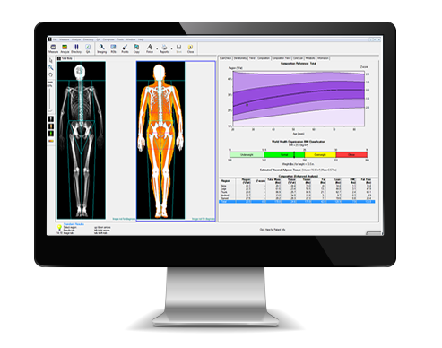 Body Analytics | 4282 Telegraph Rd, St. Louis, MO 63129, USA | Phone: (314) 471-5373