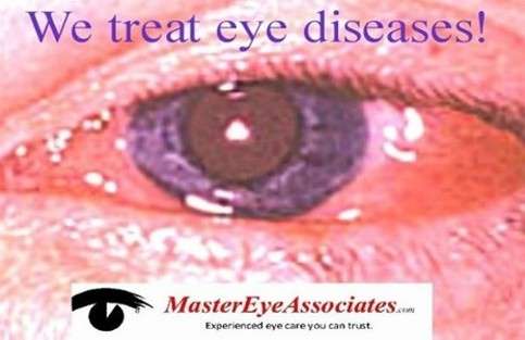 Master Eye Associates | 1076A Town East Mall, Mesquite, TX 75150, USA | Phone: (972) 681-7614