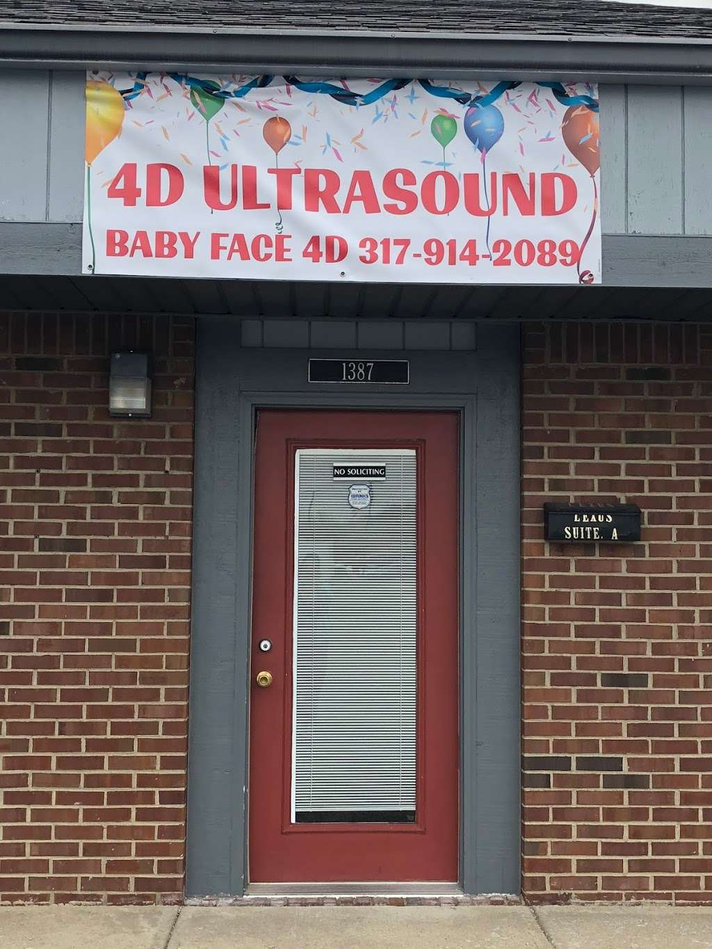 Baby Face 4D Ultrasound | 1387 Shadeland Ave suite c, Indianapolis, IN 46219, USA | Phone: (317) 914-2089