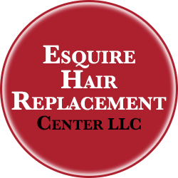 Esquire Hair Replacement Center LLC | 83 W Main St #2, Westminster, MD 21157, USA | Phone: (410) 848-2820