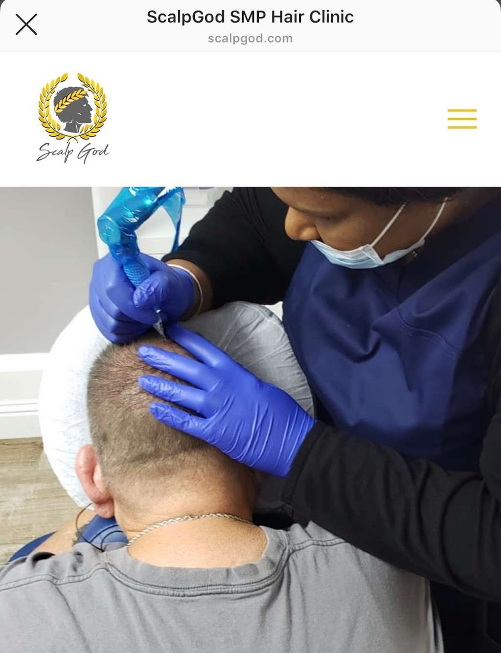 Scalp God -SMP Hair Restoration Clinic | 990 N Ontario Mills Dr Suite D, Ontario, CA 91764, USA | Phone: (909) 477-8888