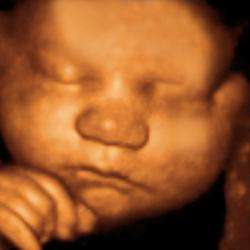 Mommys First Glance 3D 4D ultrasound | 3277 W Ridge Pike #202, Pottstown, PA 19464, USA | Phone: (484) 932-8273