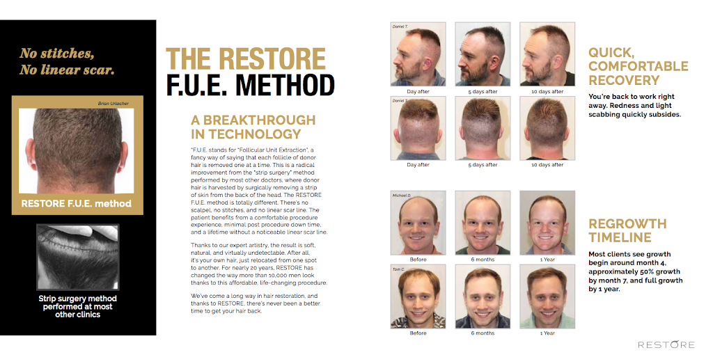 RESTORE Hair Transplant & Restoration - Dallas | 3108 Midway Rd #202a, Plano, TX 75093, USA | Phone: (866) 488-9356