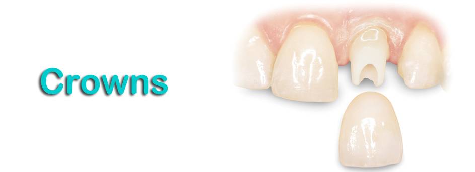 Alpha Dental Group 2 | 5870 SW 8th St Suite # 4, Miami, FL 33144, USA | Phone: (305) 392-1261