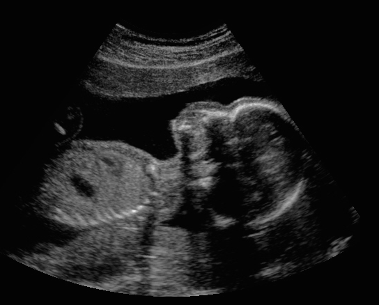 Look How Bigga Me 3D 4D HD Elective Ultrasound Studio | 7301 Bernville Rd, Bernville, PA 19506, USA | Phone: (610) 401-7318