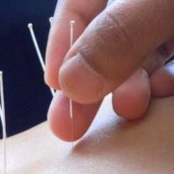 Natural Wonders Healthcare & Acupuncture in La Puente | 1363 N Hacienda Blvd, La Puente, CA 91744 | Phone: (626) 377-0753