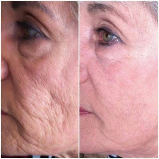 Amazing Skin | 13 Oakland Rd, Pepperell, MA 01463 | Phone: (978) 877-0972