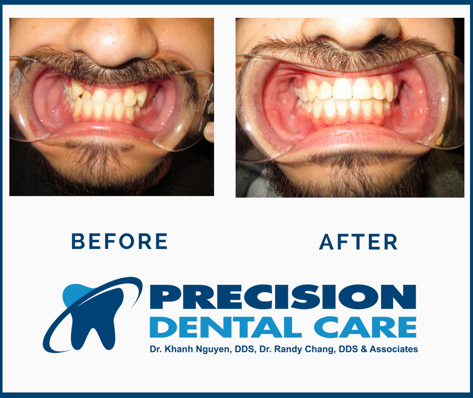 Precision Dental Care | 4317 S Ashland Ave, Chicago, IL 60609 | Phone: (773) 579-0422