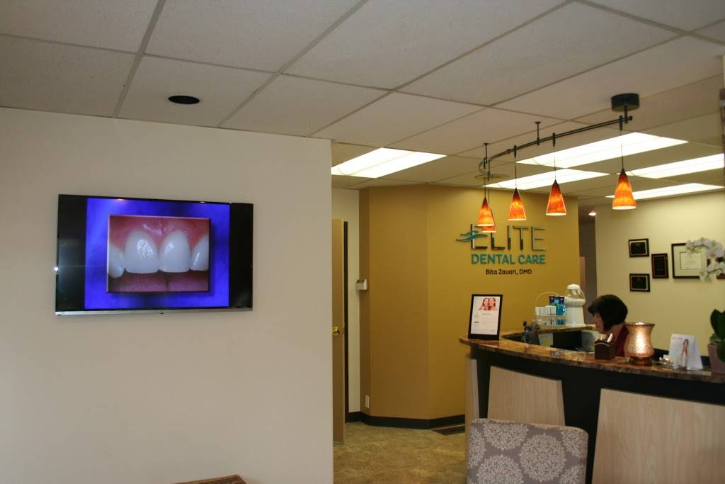 Elite Dental Care | Dentist Beaverton - Cedar Hills | 1600 SW Cedar Hills Blvd #110, Portland, OR 97225, USA | Phone: (503) 292-2125