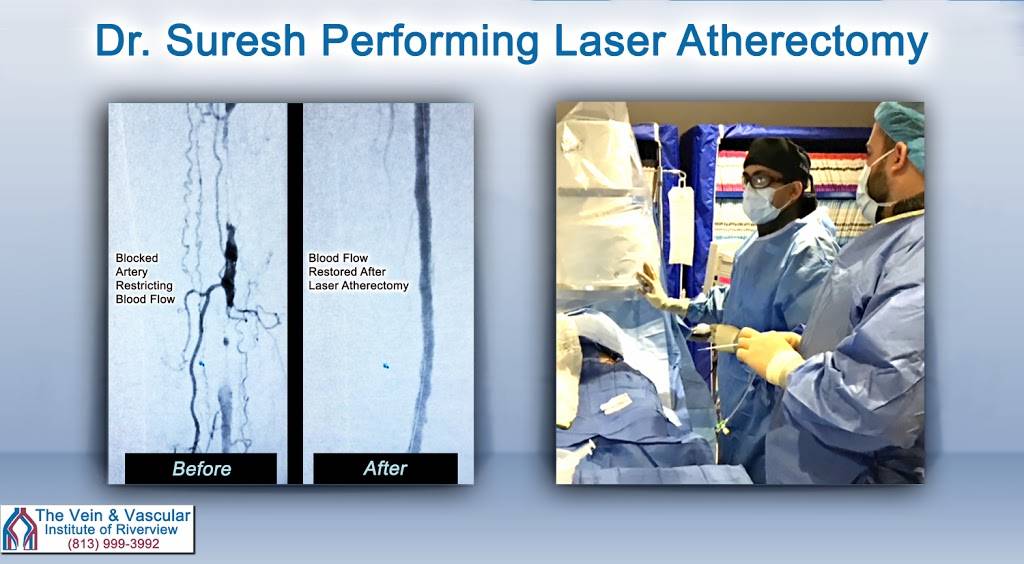 Adithya Suresh, MD RPVI ACS - Vascular Surgeon in Riverview | 3140 S Falkenburg Rd #202, Riverview, FL 33578, USA | Phone: (813) 999-3992