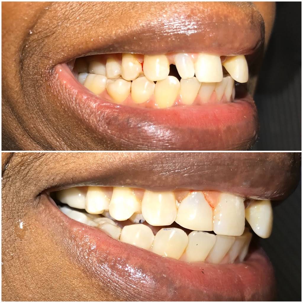 Perfect Smile Dental: Karen V. Bergonio, DDS | 307 Boulevard, Hasbrouck Heights, NJ 07604, USA | Phone: (201) 257-8452
