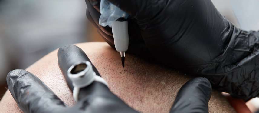 Scalp Micro HTX | 6510 Bellfort St C, Houston, TX 77087, USA | Phone: (832) 303-1722