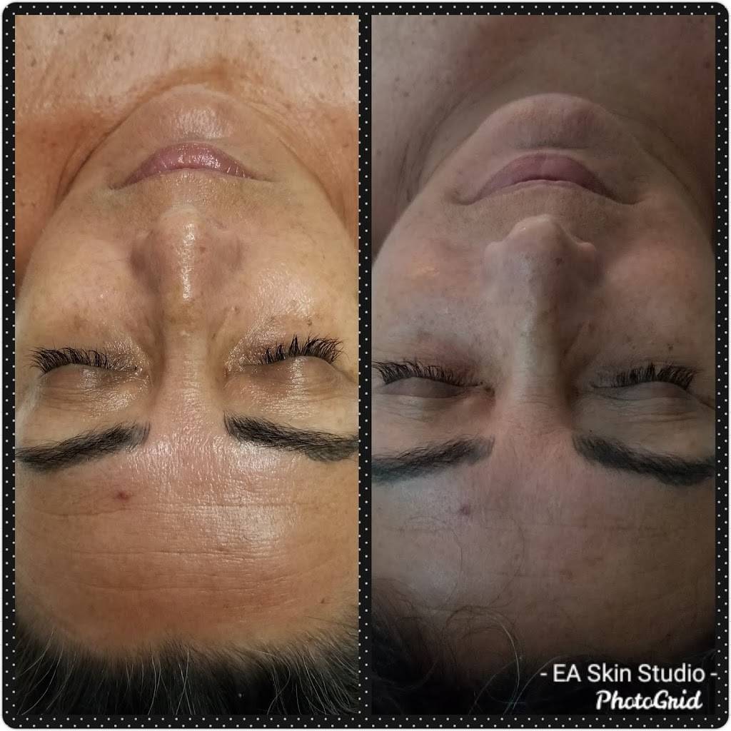 EA Skin Studio | 2315 E Imperial Hwy #120, Brea, CA 92821, USA | Phone: (562) 760-0622