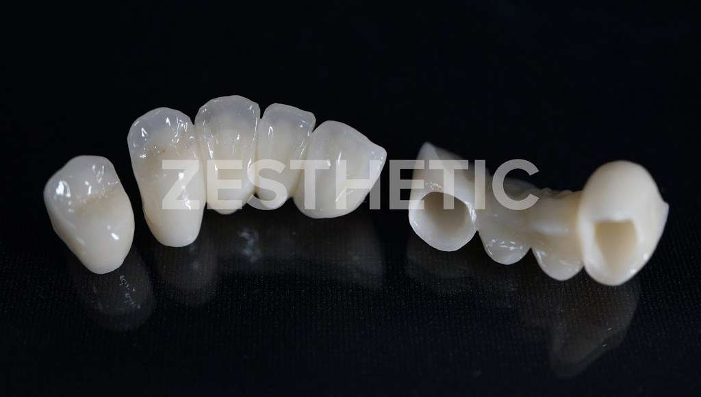 Zesthetic Dental Laboratory | 5150 E La Palma Ave #113, Anaheim, CA 92807, USA | Phone: (714) 340-3102