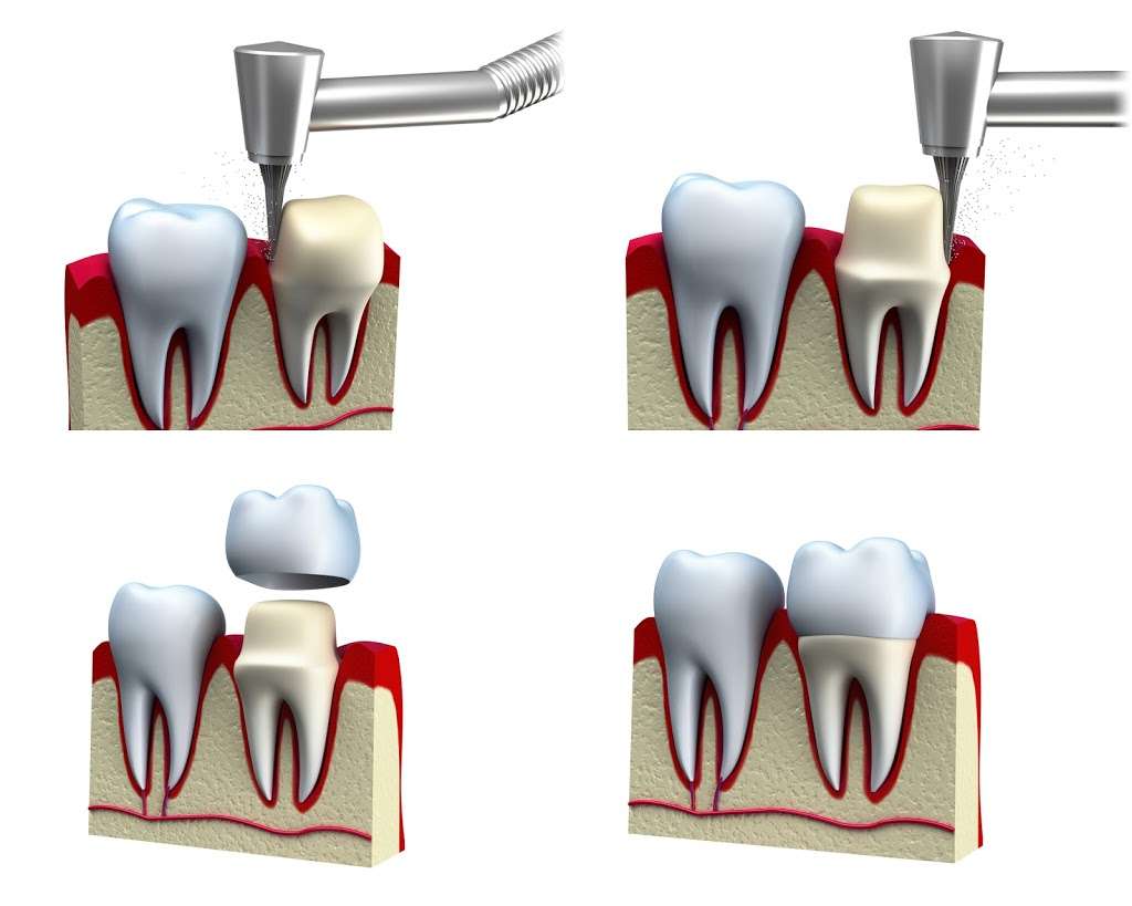 Mid City Dentistry | 13400 Artesia Blvd #8806, Cerritos, CA 90703, USA | Phone: (562) 921-0898