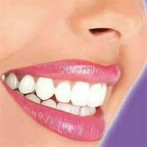 Malibu Teeth Whitening-Parham Medical Village- | 2103 E Parham Rd #204, Richmond, VA 23228, USA | Phone: (804) 629-3390