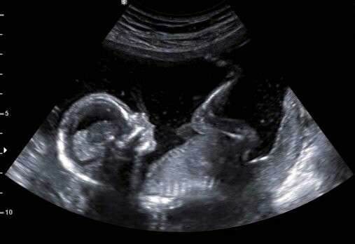 Baby To Be 3D | 913 W Main St, Plymouth, PA 18651, USA | Phone: (570) 550-5299