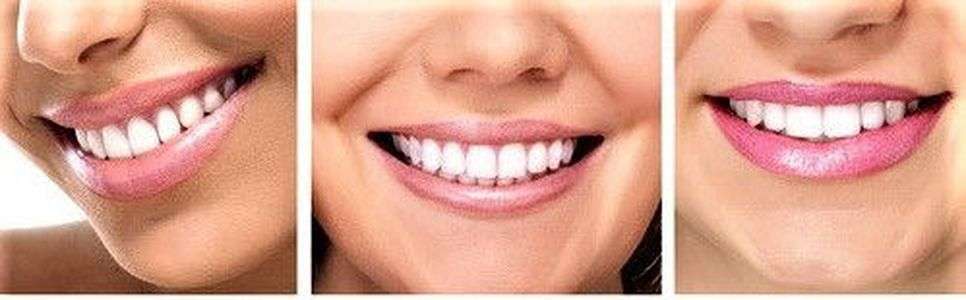 Smile By Design | 1288 Valley Forge Rd Unit 52, Phoenixville, PA 19460 | Phone: (484) 920-3687