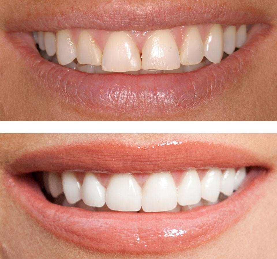 Dedicated Dentistry: Tamara J. Herremans, DDS | 965 S Kipling Pkwy ste a, Lakewood, CO 80226, USA | Phone: (303) 984-1400