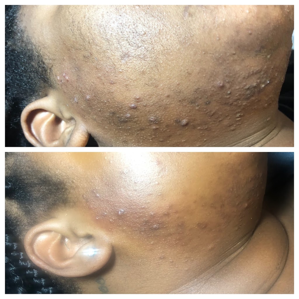 Skin By Donna LLC | 8936 Airways Blvd Suite 5, Southaven, MS 38671, USA | Phone: (901) 228-3210