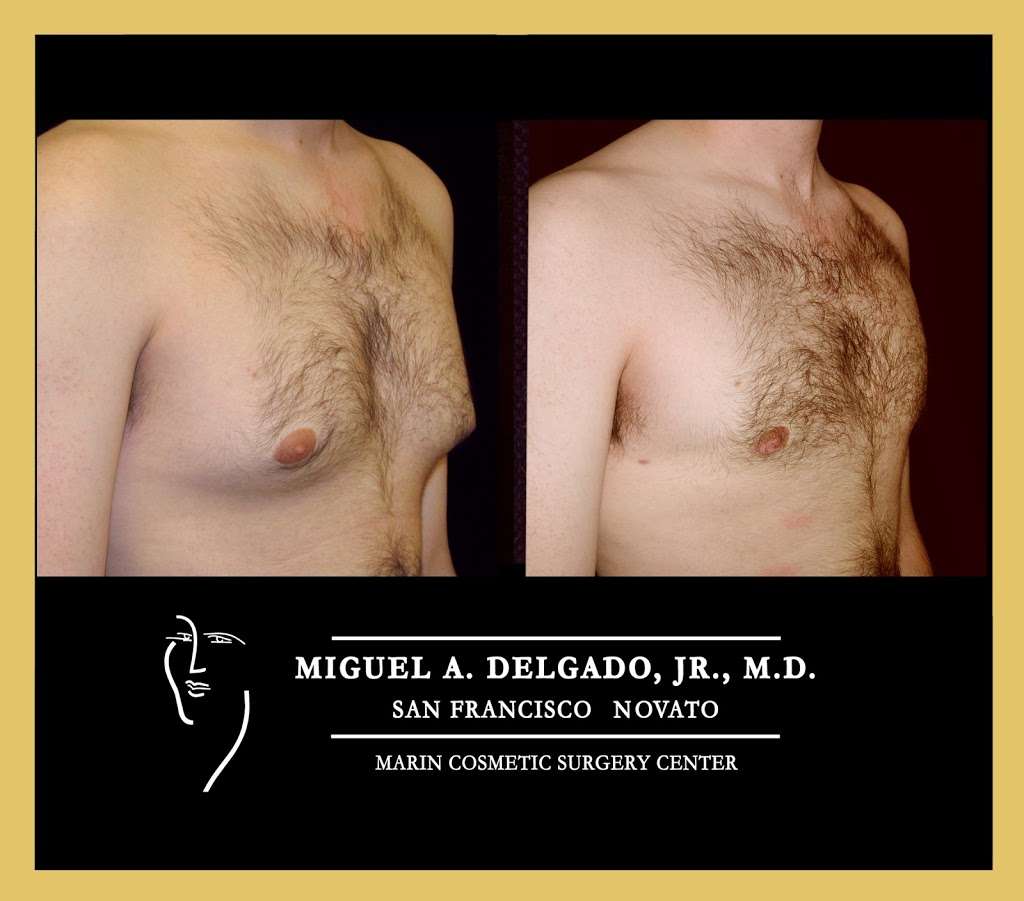 Miguel Delgado, M.D. | 165 Rowland Way Suite 300, Novato, CA 94945, USA | Phone: (415) 898-4161