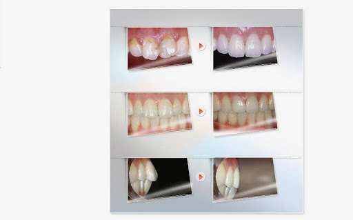 A Plus Dental | 2520 W 8th St, Los Angeles, CA 90057, USA | Phone: (213) 380-1894