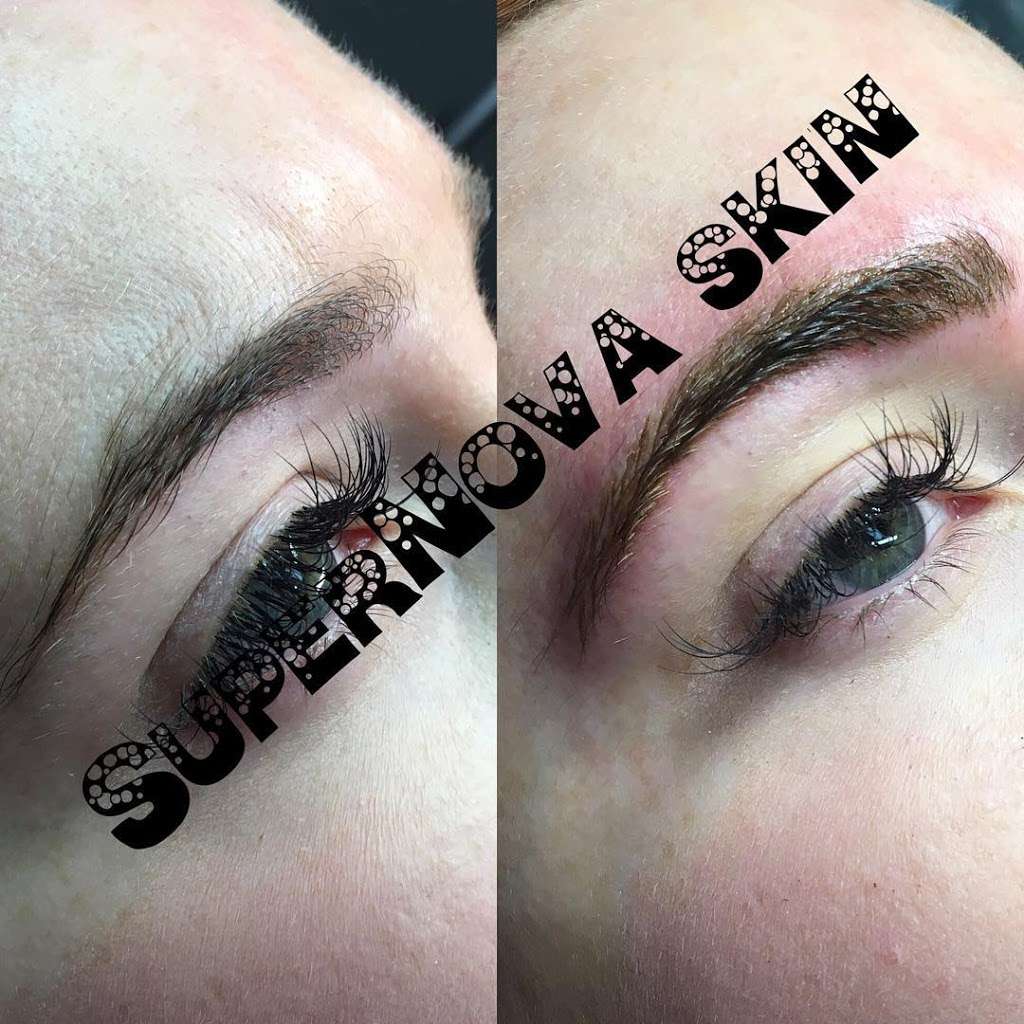 SuperNova Skin | 26400 Kuykendahl Rd Suite C145, Tomball, TX 77375, USA | Phone: (832) 559-0235