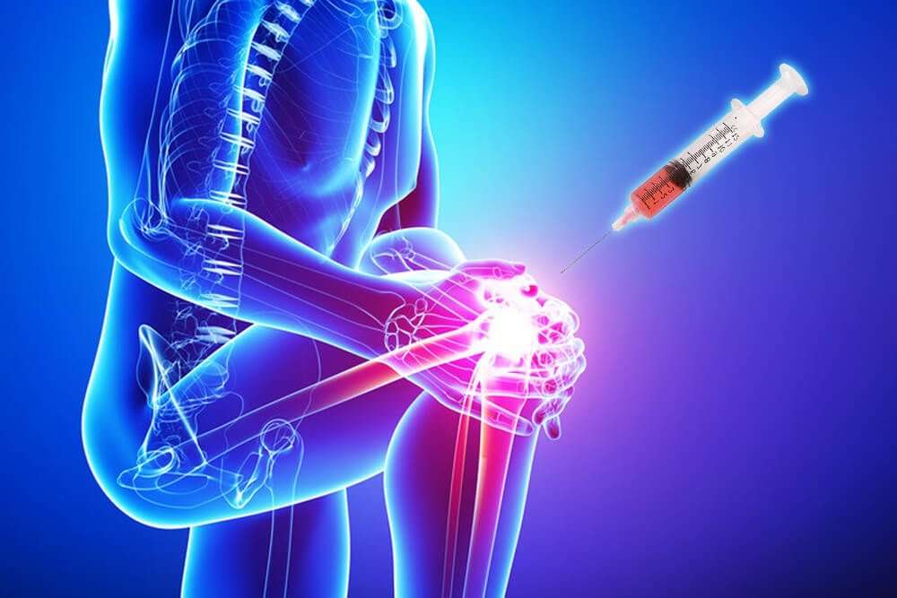 Arthritis Pain Management | 114-20 Rockaway Blvd suite 200, South Ozone Park, NY 11420, USA | Phone: (646) 647-8841