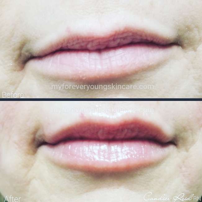 Forever Young Skin Care | 7600 Stenton Ave #1k, Philadelphia, PA 19118, USA | Phone: (267) 415-6556