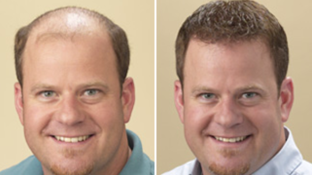 Waynes Concept Hair Replacement | 2503 S High St, Columbus, OH 43207, USA | Phone: (614) 444-7336