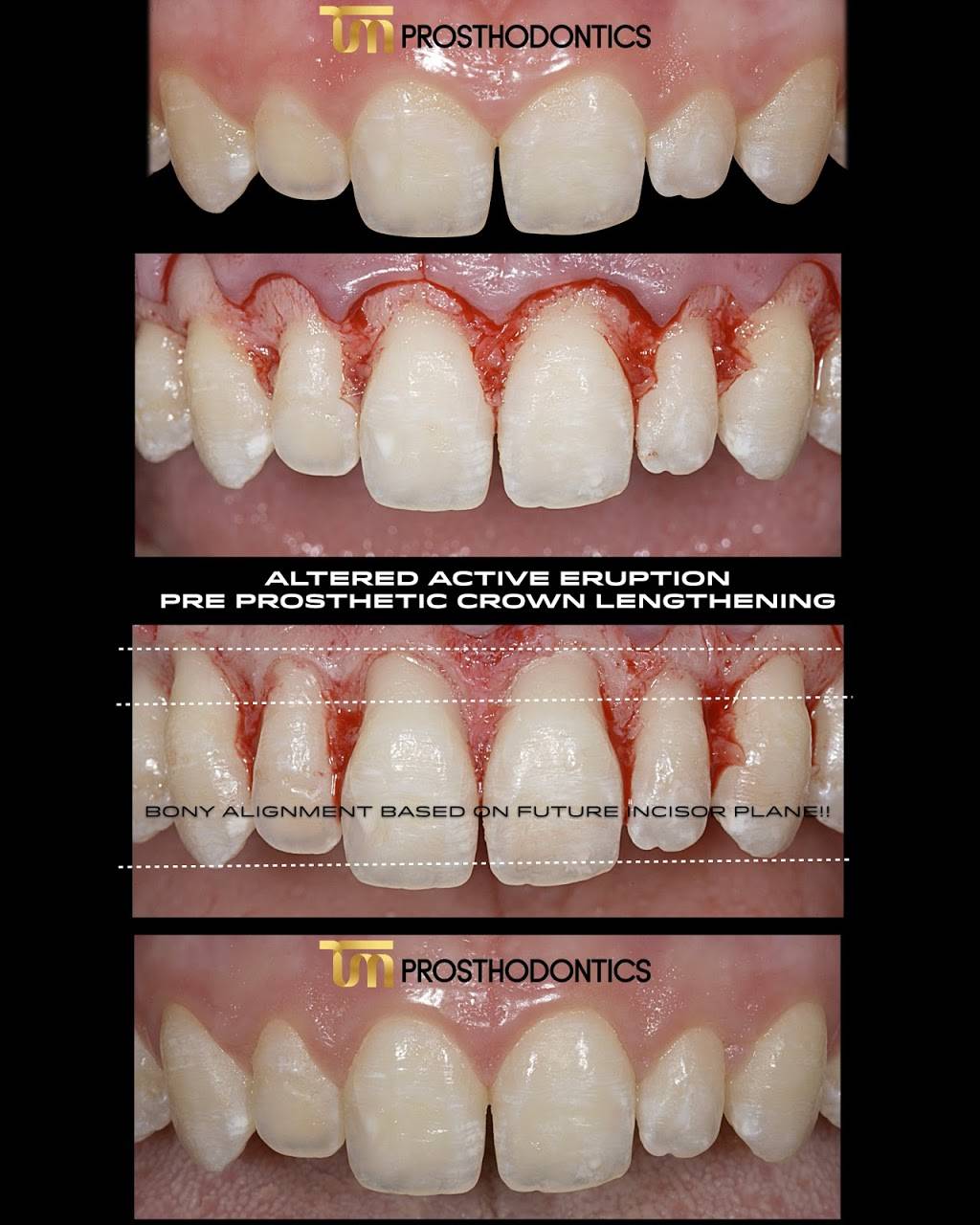 TM Prosthodontics - Dr. Tal Morr | 20760 W Dixie Hwy, Miami, FL 33180, USA | Phone: (305) 935-6066