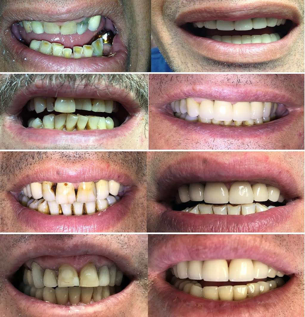 Sterling Smile Dental Care | 18856 Roscoe Blvd Ste A, Northridge, CA 91324, USA | Phone: (818) 885-7117