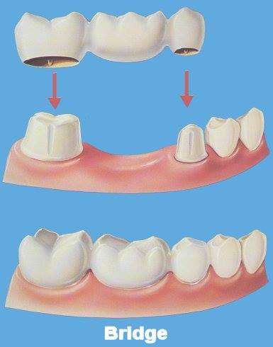 Island Dental | 6206 Antoine Dr, Houston, TX 77091, USA | Phone: (713) 263-8900