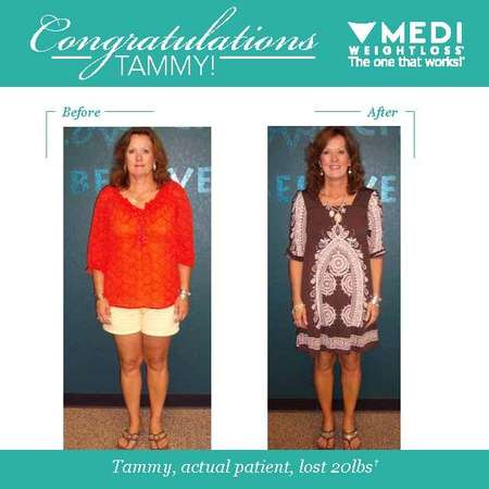 Medi-Weightloss | 8706 Fredericksburg Rd Suite 102, San Antonio, TX 78240 | Phone: (210) 697-9500