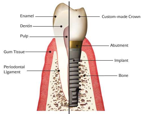 PearlFection Dentistry Urbana Maryland | 3280 Urbana Pike #203, Ijamsville, MD 21754 | Phone: (301) 831-8303