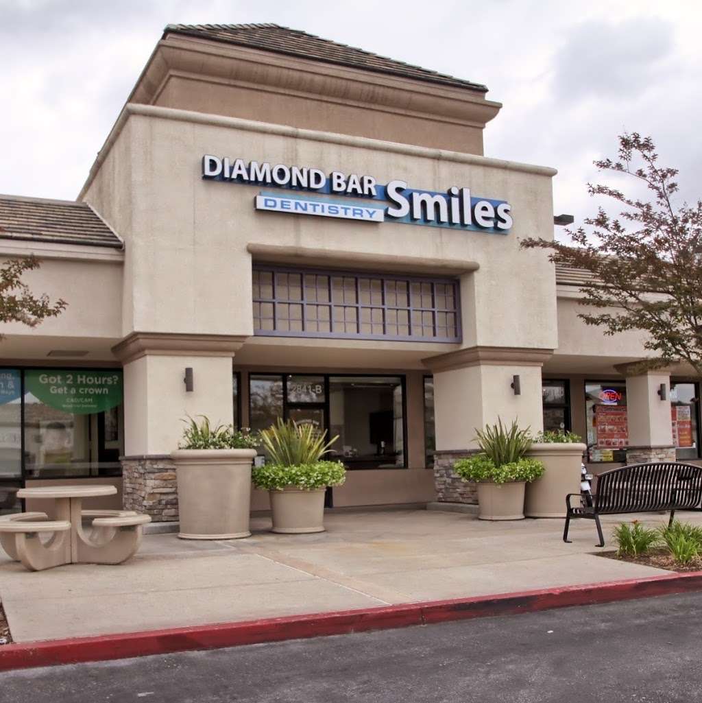 Diamond Bar Smiles Dentistry | 2841 S Diamond Bar Blvd Ste B, Diamond Bar, CA 91765, USA | Phone: (909) 860-6232