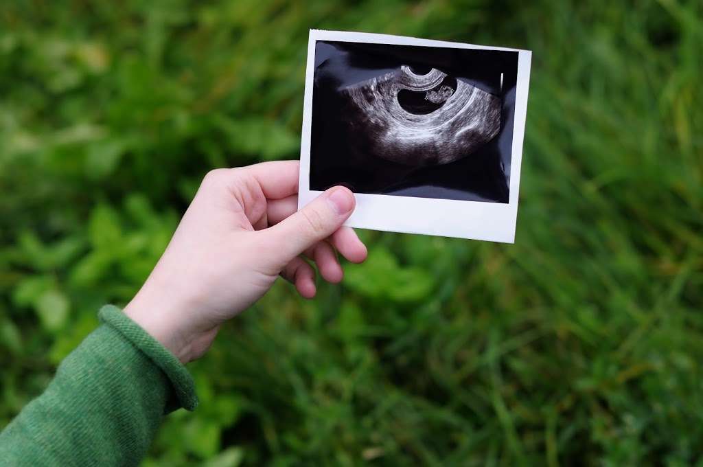 ULTRASONIDO | ULTRASOUND | ELECTROCARDIOGRAMA | MEDICINA DIAGNÓS | Av. José López Portillo Pte. #317, Nueva Tijuana, 22435 Tijuana, B.C., Mexico | Phone: 664 623 6692