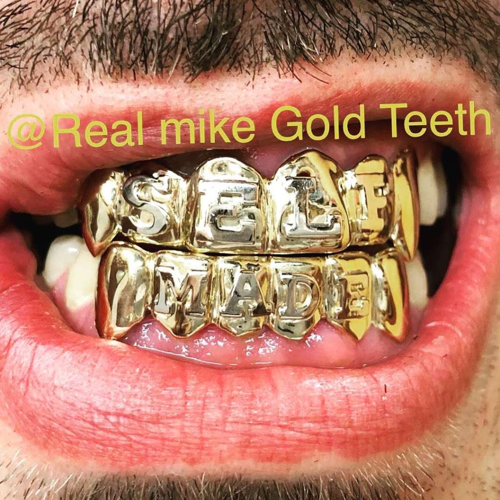 Real Mike Gold Teeth | 7900 NW 27th Ave 2nd floor, Unit C07, Miami, FL 33147, USA | Phone: (786) 527-1108