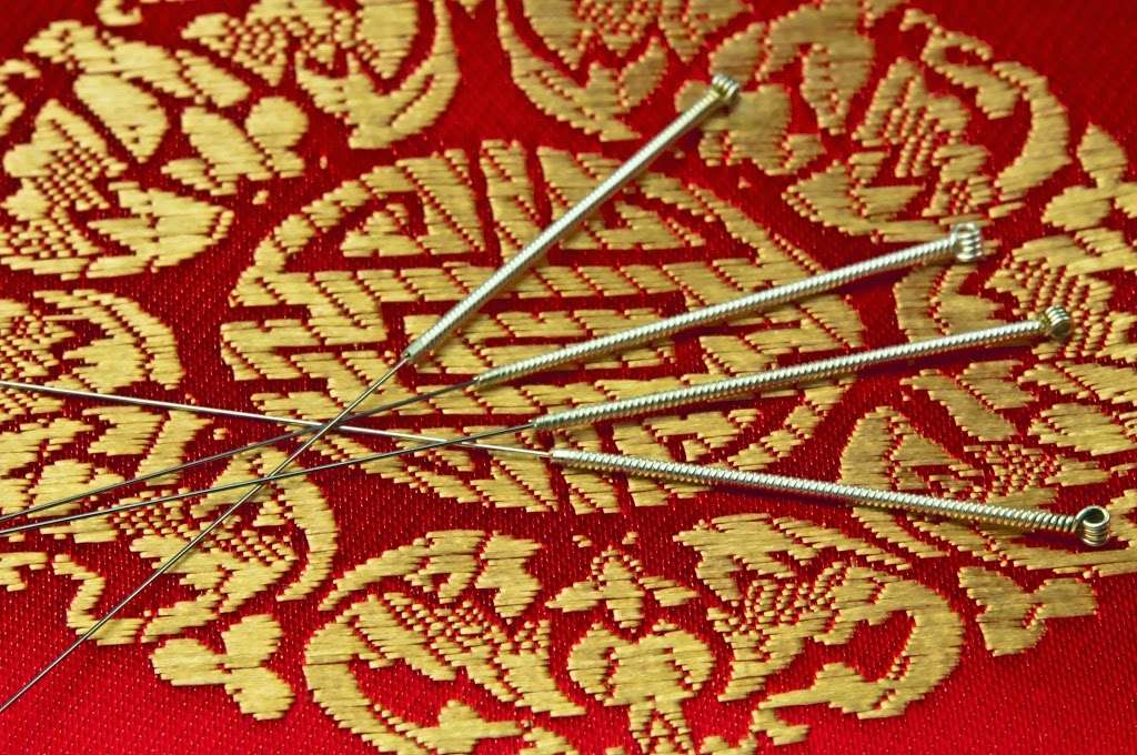 TAO Medicine Acupuncture & Healing | 908 Oak Tree Avenue o, South Plainfield, NJ 07080, USA | Phone: (908) 822-8898