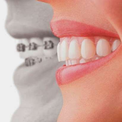 RS Orthodontics | 319 Lutz Ave, Martinsburg, WV 25404, USA | Phone: (304) 944-0549