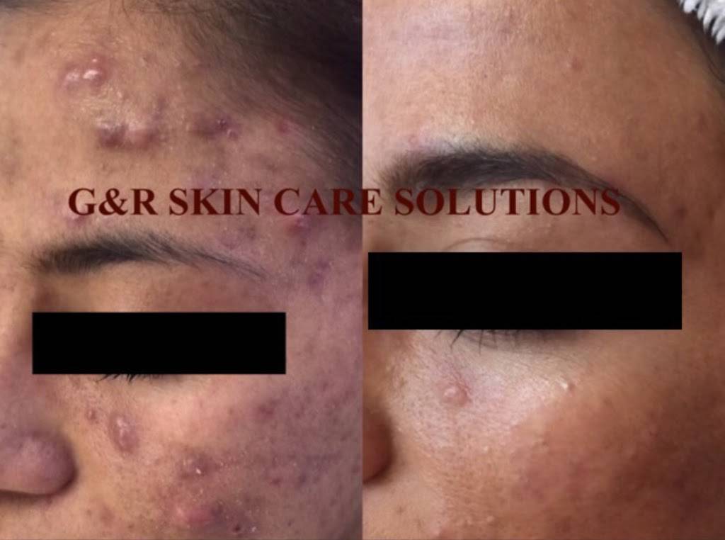 G&R Skin Care Solutions | 6700 West Gate Blvd #102, Austin, TX 78745 | Phone: (512) 945-3080